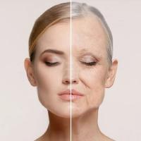 Anti Aging treatment