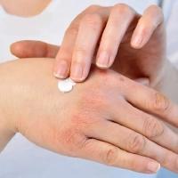Dry Skin treatment