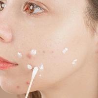 Spot treatment