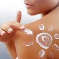 Sun Burn treatment